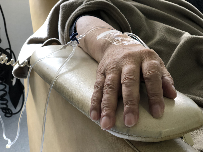chemotherapy Extranodal Natural Killer/ T-Cell Lymphoma