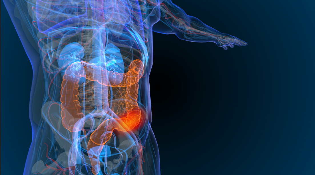 Gastrointestinal Cancer
